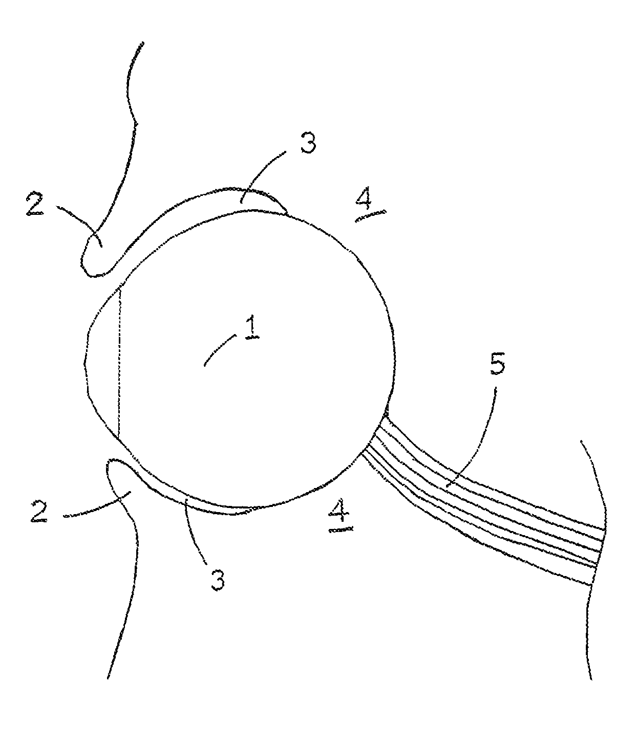 Medical device and method for temperature control and treatment of the eye and surrounding tissues via magnetic drug therapy