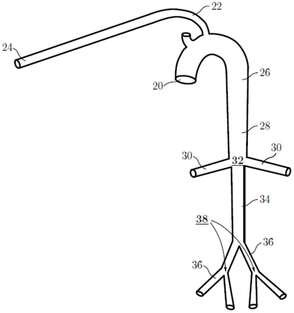 System for measuring hardening index of artery network