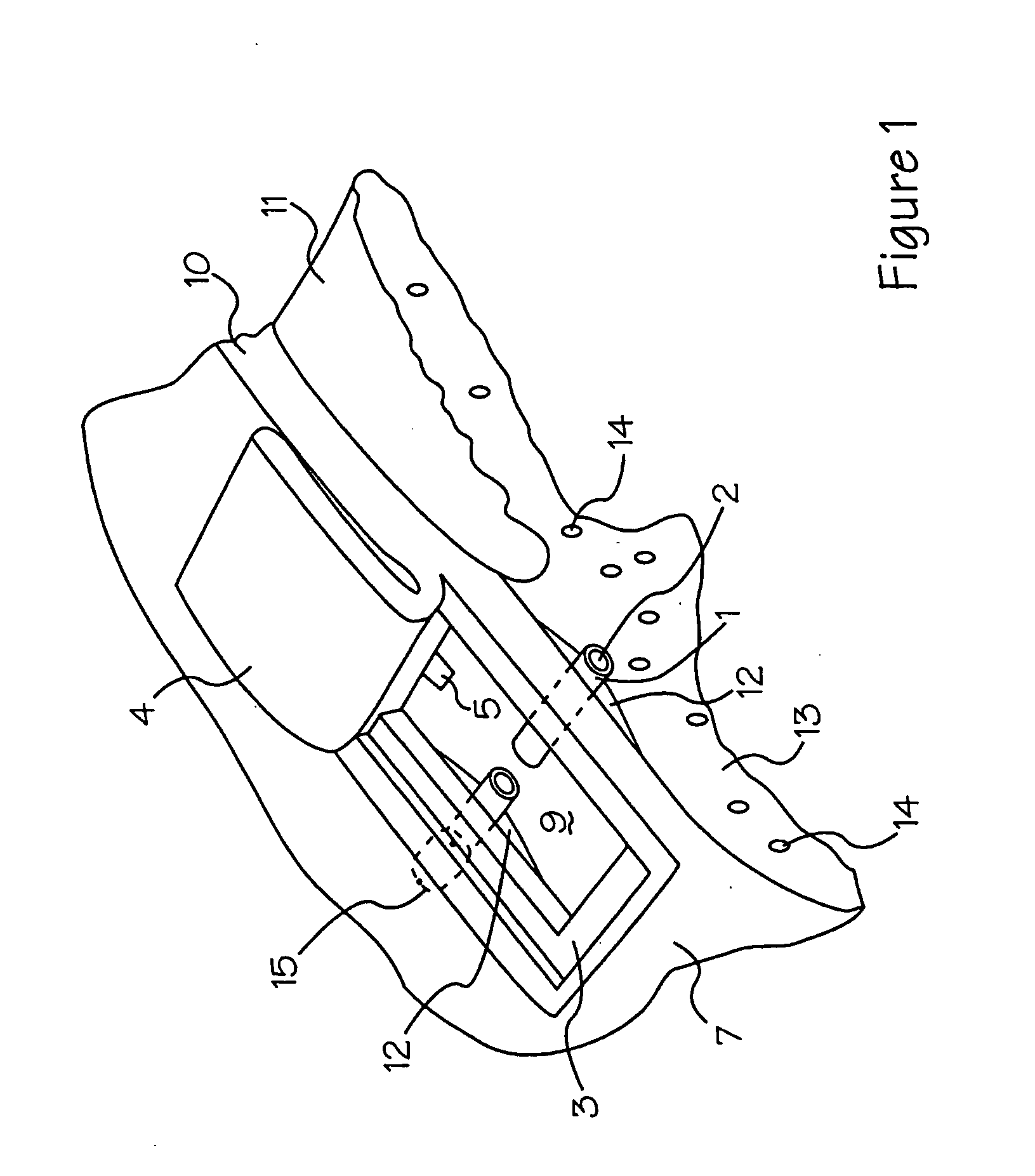 Internal shunt and method for treating glaucoma