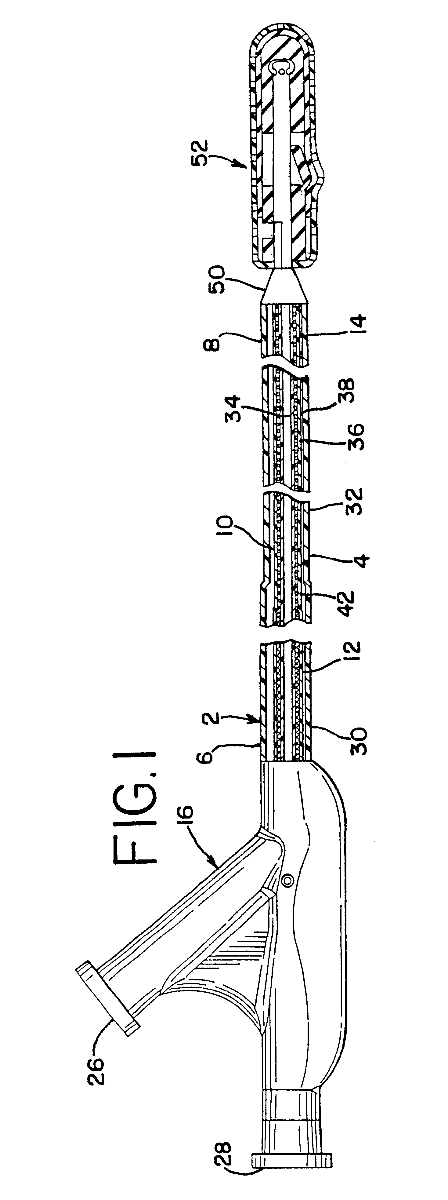 Detachable balloon embolization device and method