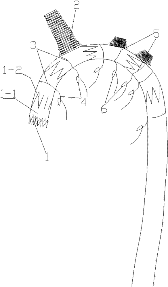 A kind of aortic covered branch stent