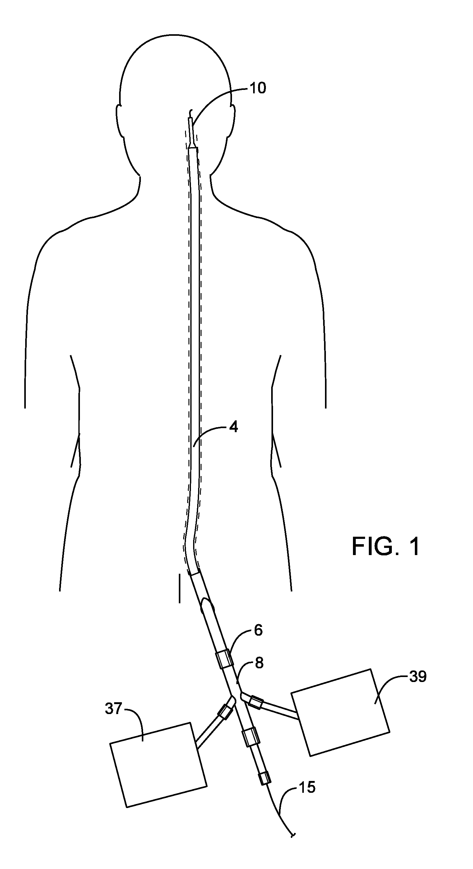 Methods and devices for protecting a passageway in a body when advancing devices through the passageway