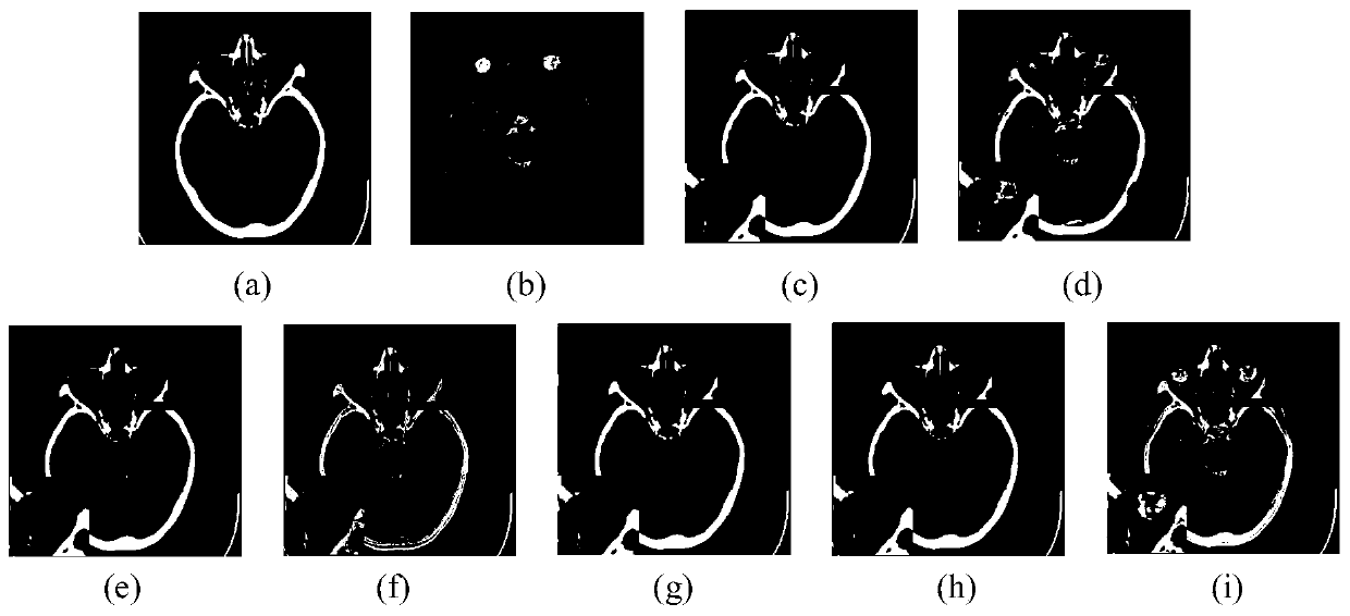 Medical image fusion method based on improved pulse coupling neural network