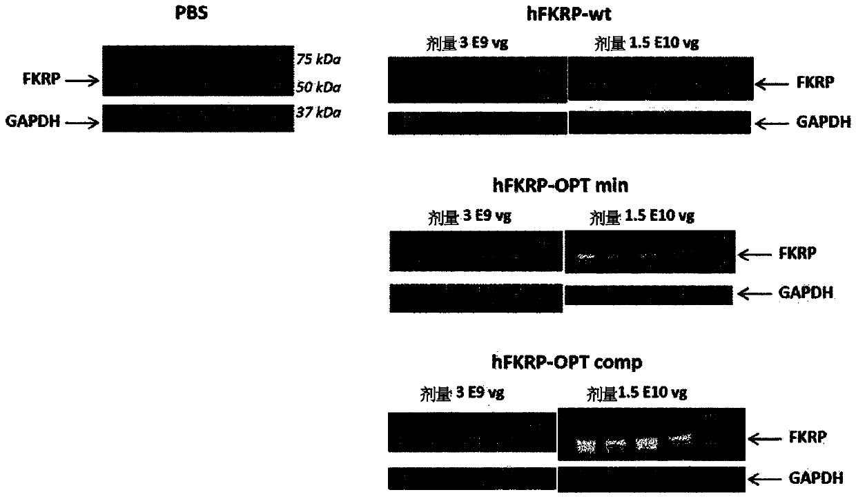 Novel polynucleotides encoding a human fkrp protein