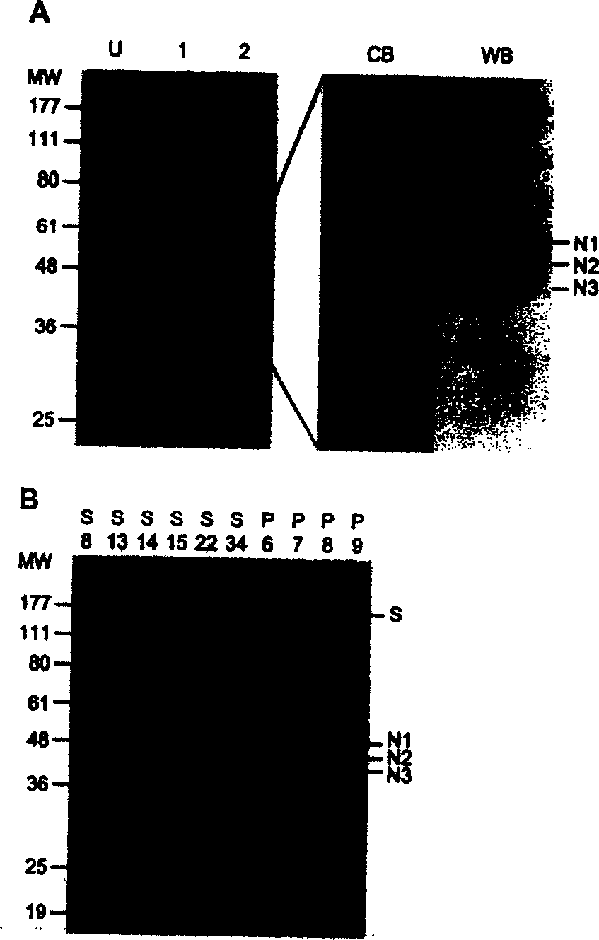 Composition and method for diagnosing and preventing serious acute respiratory syndrome(SARS)