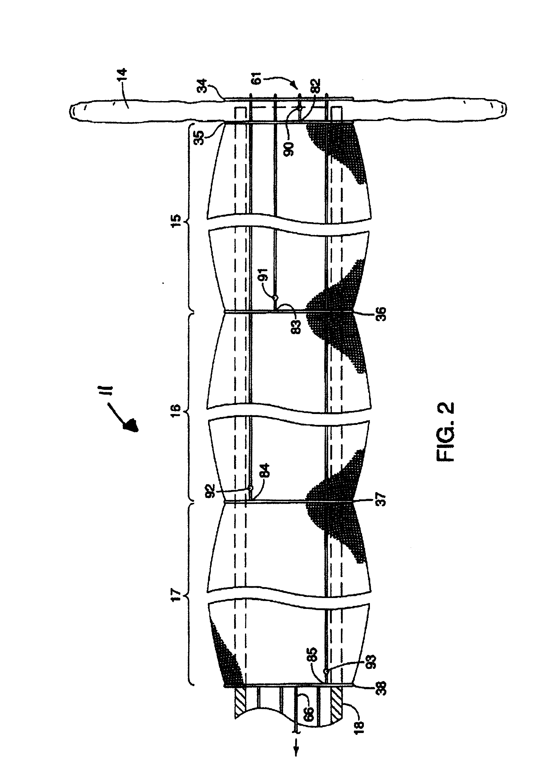 Method of delivering an intragastric device for treating obesity