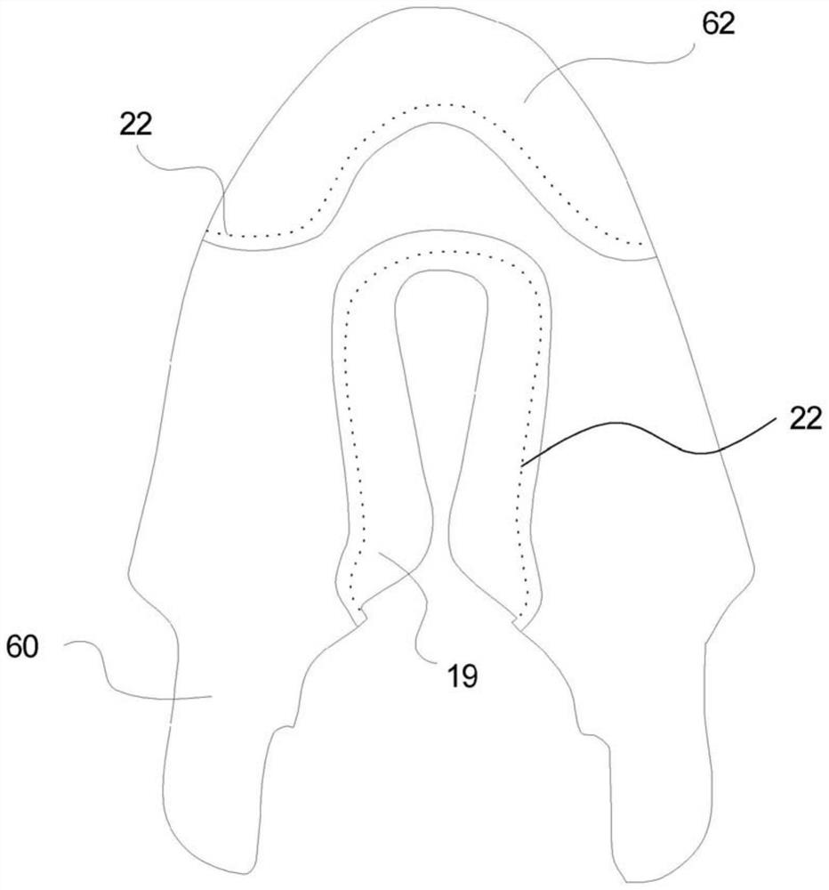 Automatic stitching of footwear components