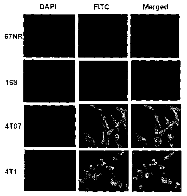 Protein involved in detection of cancer metastasis and a treatment thereof