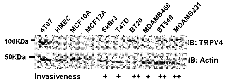 Protein involved in detection of cancer metastasis and a treatment thereof