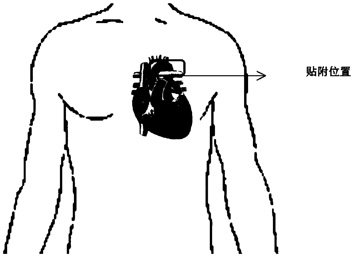 Chest non-invasive blood pressure detection method based on pulse wave conduction time