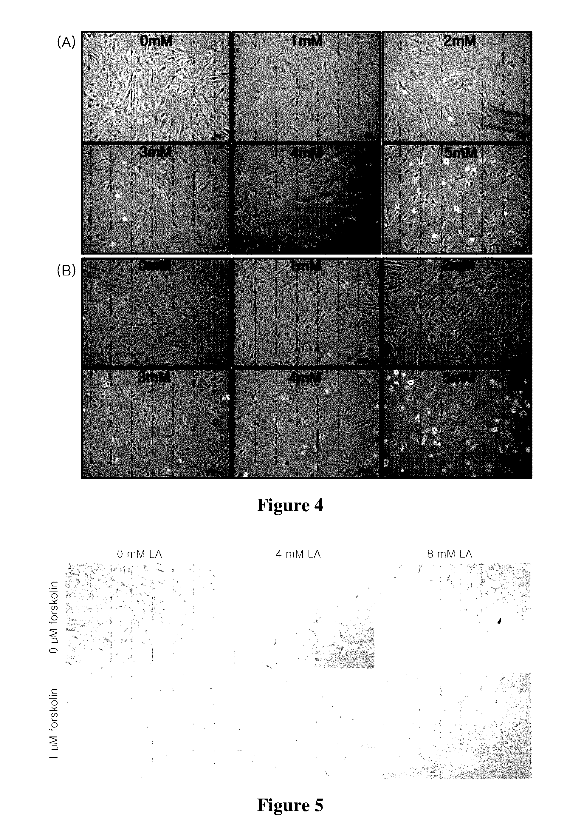 Method for differentiating stem cells into neurons