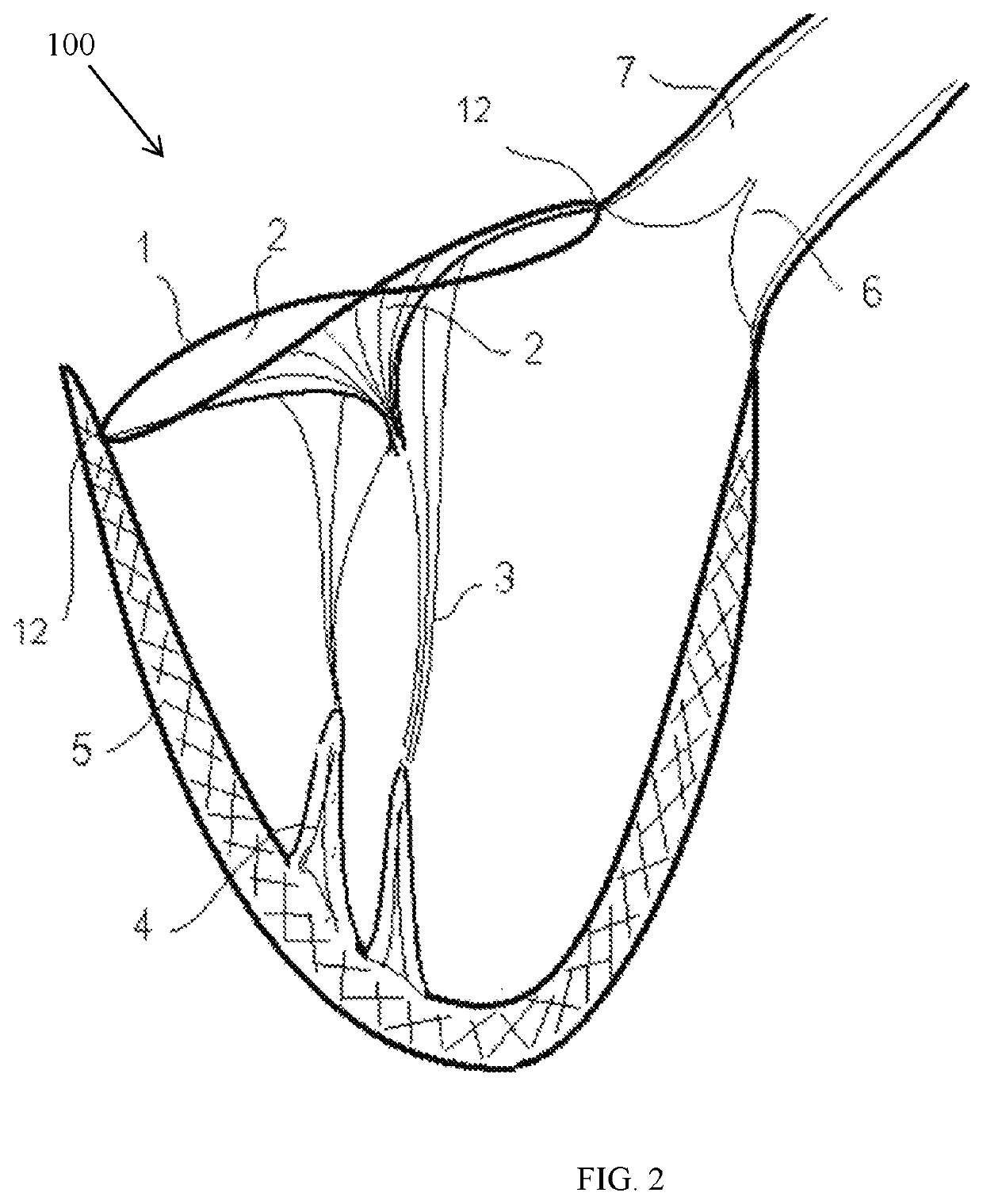 Naturally designed mitral prosthesis