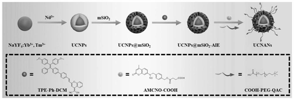 Nano composite system with nitric oxide/photodynamic synergistic antibacterial and anti-inflammatory effects as well as preparation method and application of nano composite system