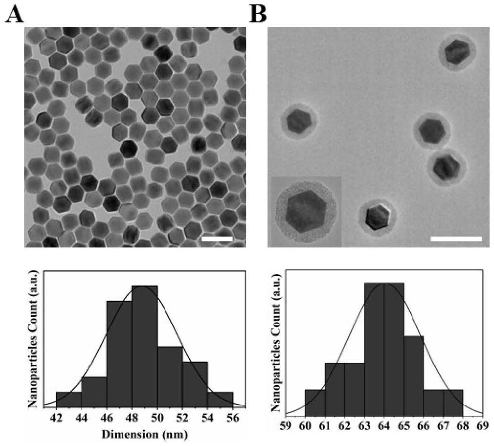 Nano composite system with nitric oxide/photodynamic synergistic antibacterial and anti-inflammatory effects as well as preparation method and application of nano composite system