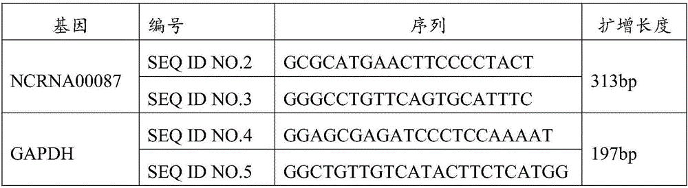 Diagnosis and treatment marker of prostate cancer