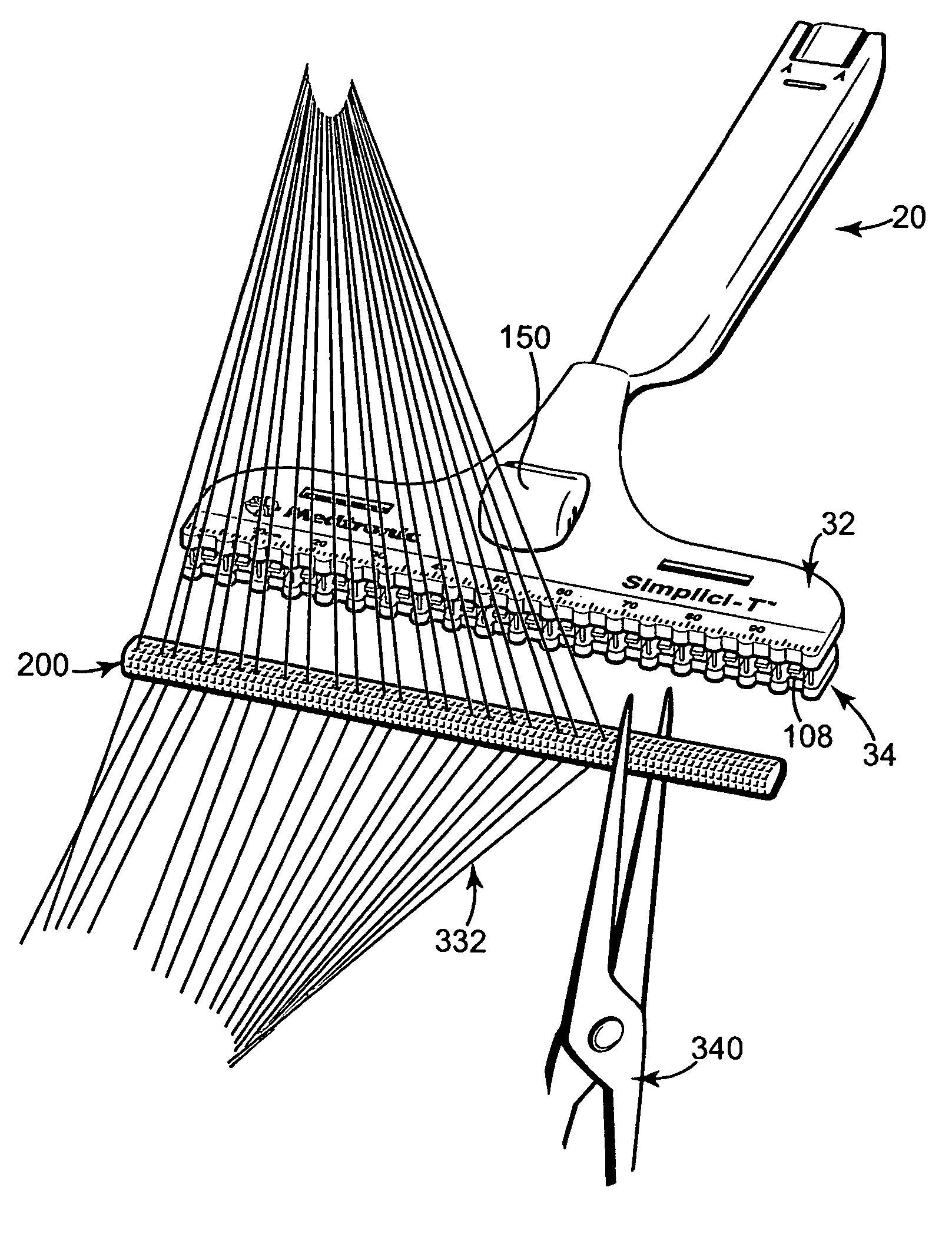 Method of implanting an annuloplasty prosthesis