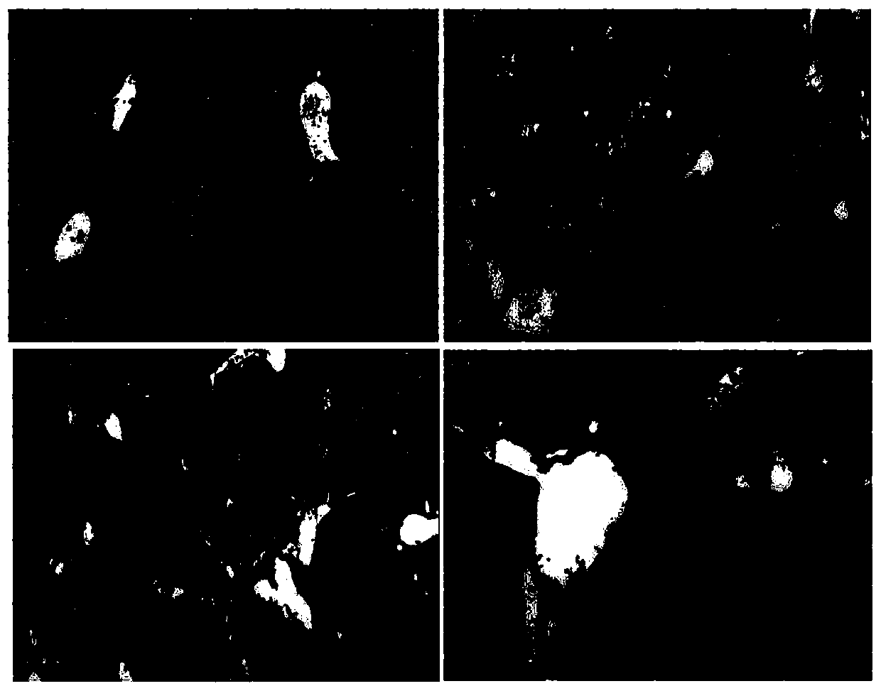 Application of 5-hydroxy-2-decenoic acid in preparation of drug for anti-liver fibrosis, chronic liver disease, liver cirrhosis and liver cancer