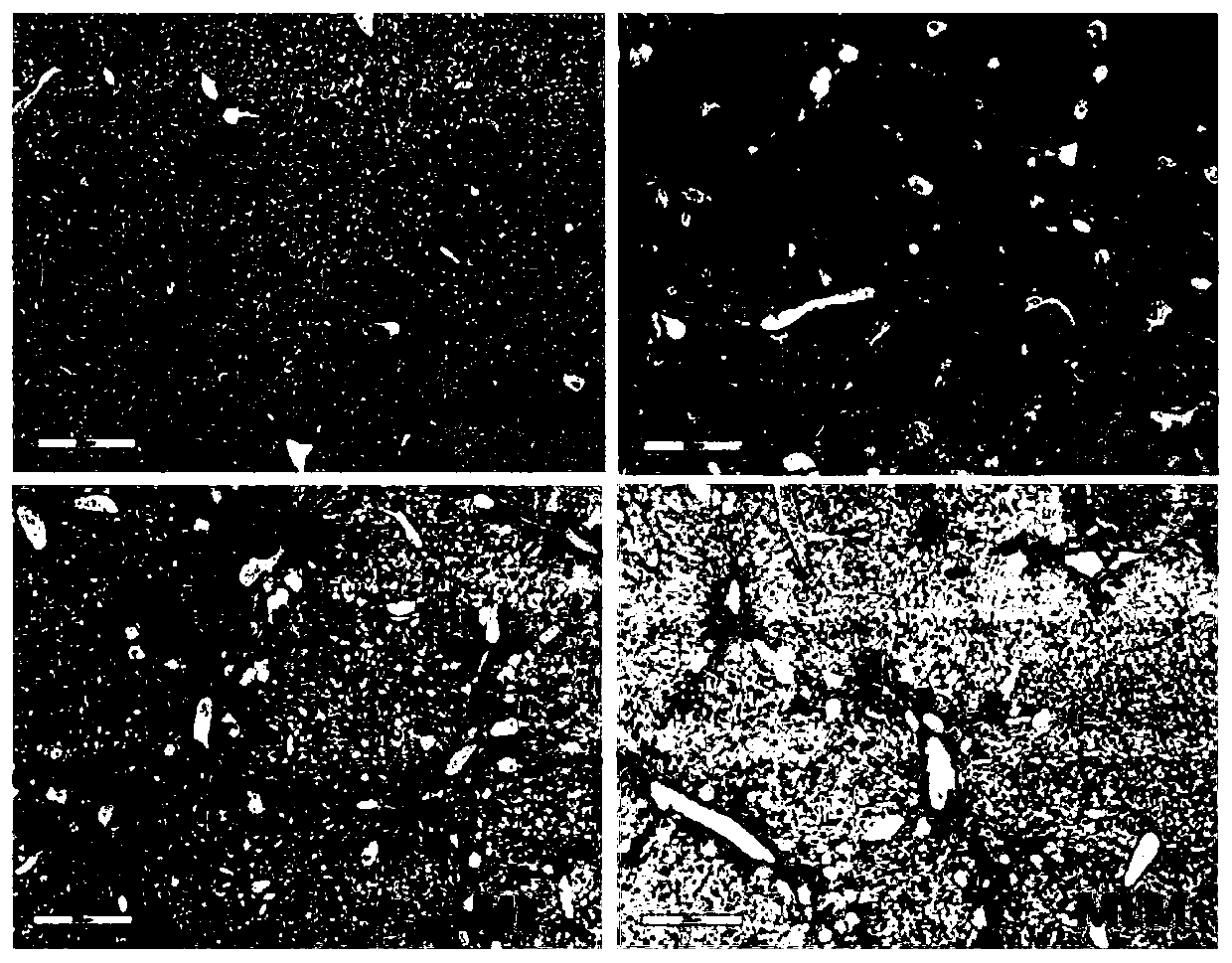 Application of 5-hydroxy-2-decenoic acid in preparation of drug for anti-liver fibrosis, chronic liver disease, liver cirrhosis and liver cancer