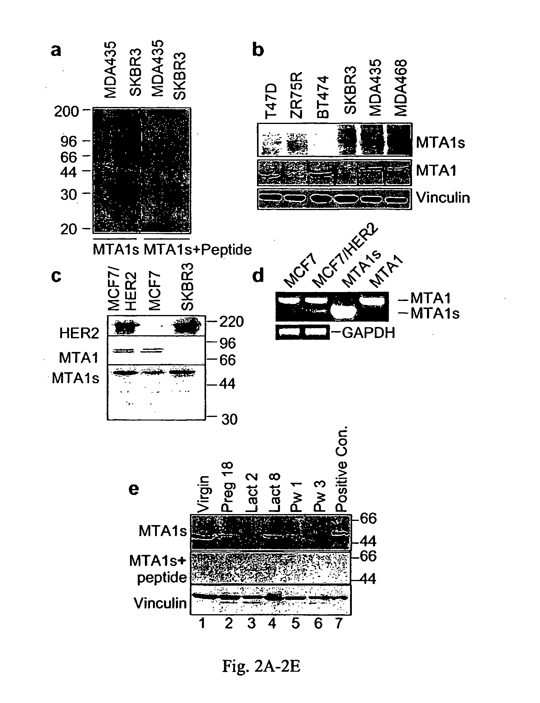Mta1s, a steriod hormone receptor corepressor