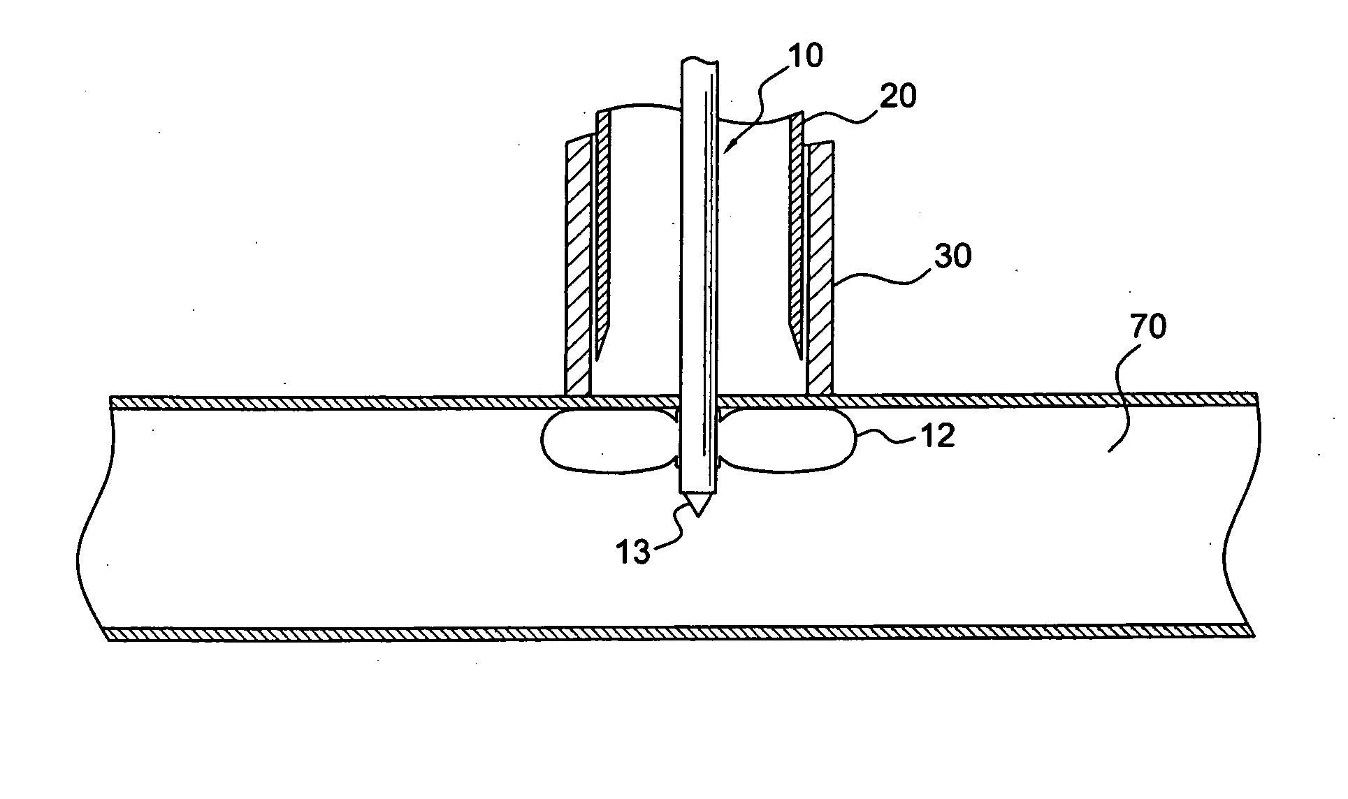 Apparatus and method for connecting a conduit to a hollow vessel