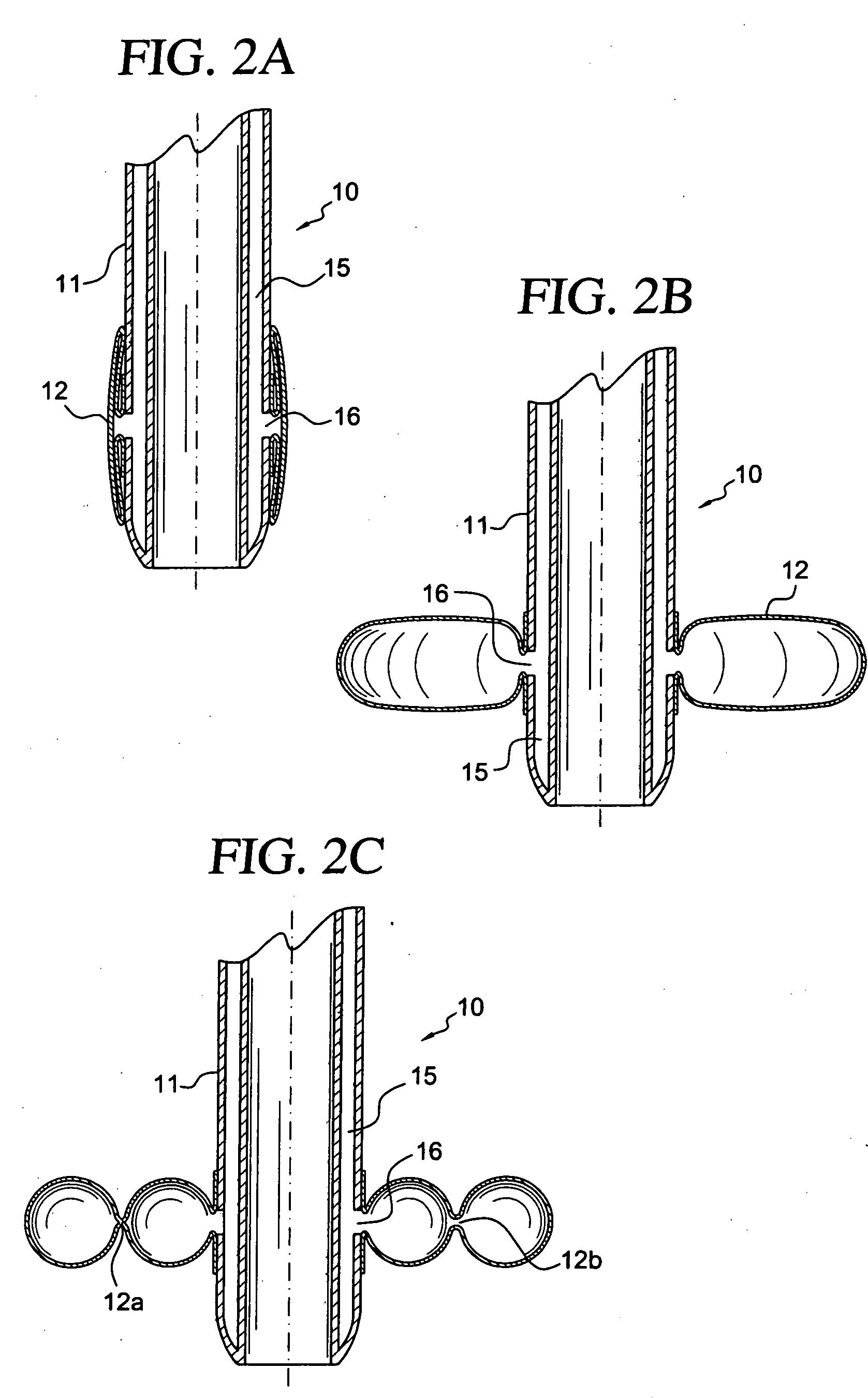 Apparatus and method for connecting a conduit to a hollow vessel