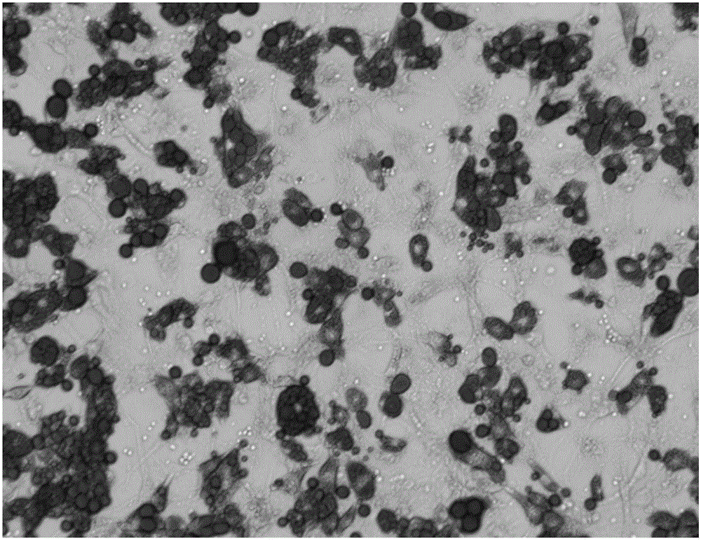 Induced differentiation method of 3T3-L1 preadipocytes line