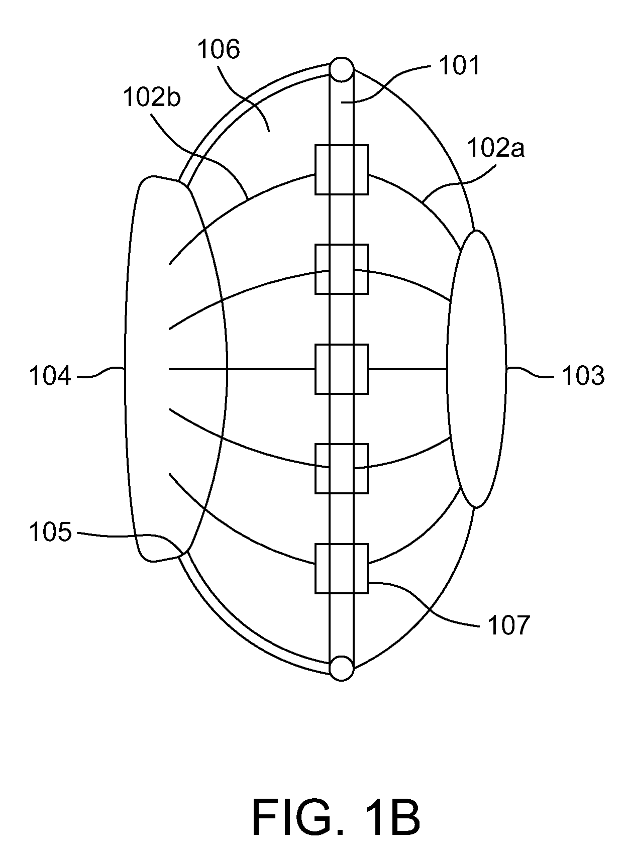 Intraocular lens (IOL) with multi optics assembly