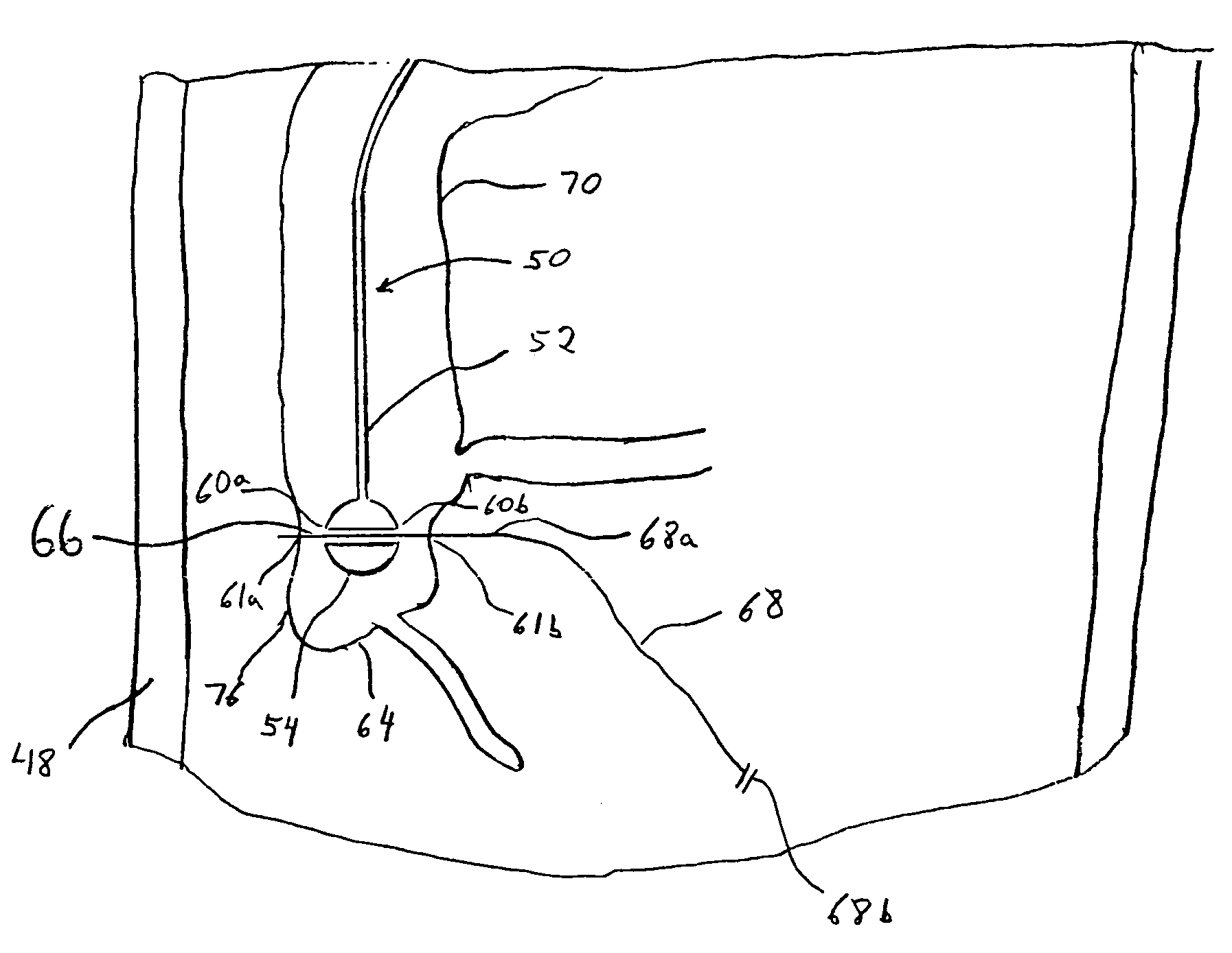 Tubular apparatus for drainage of the colon and method and guidewire for colonic intubation