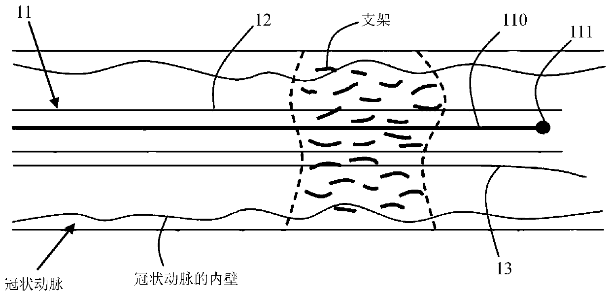 OCT-based automatic detection and evaluation method and system for cardiovascular implanted stents