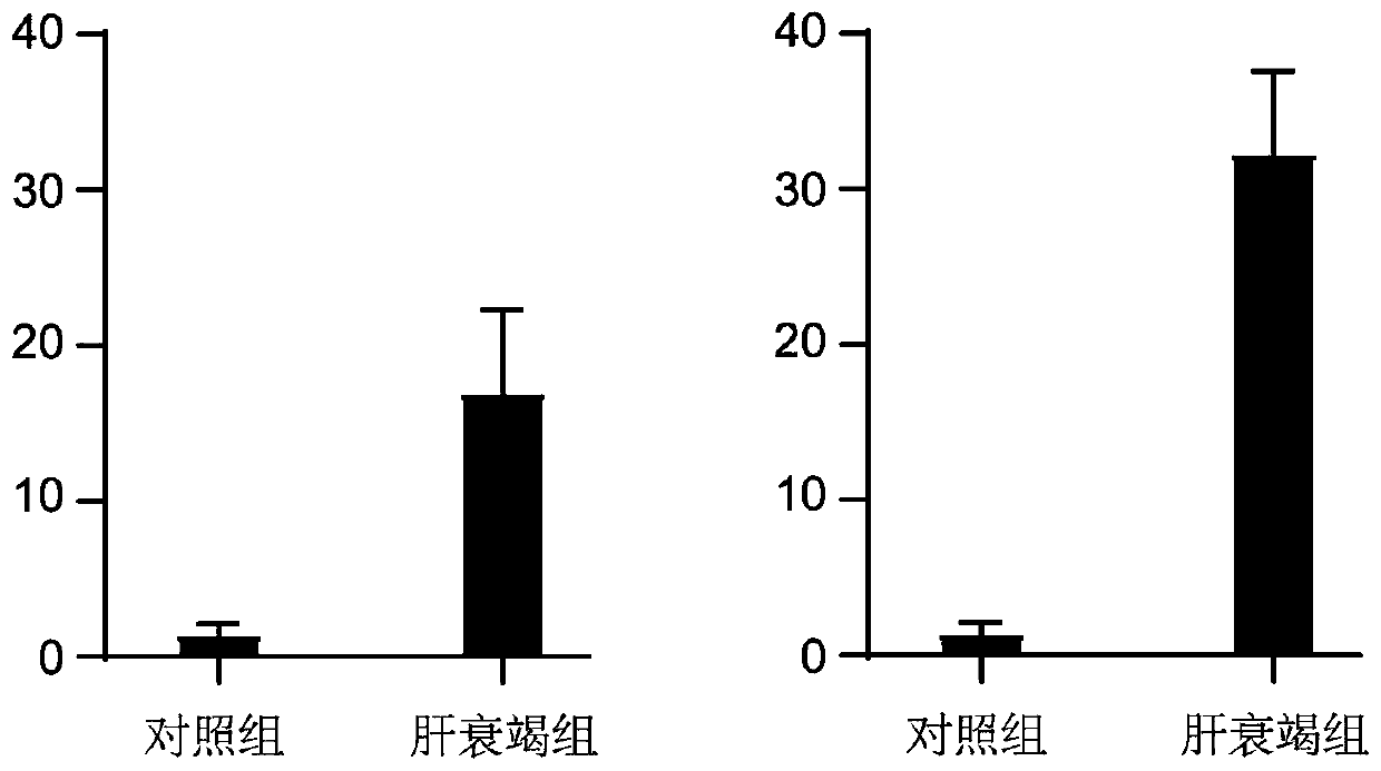 New purpose of AMPH for diagnosing hepatic failure, reagent kit and application of reagent kit for diagnosing hepatic failure