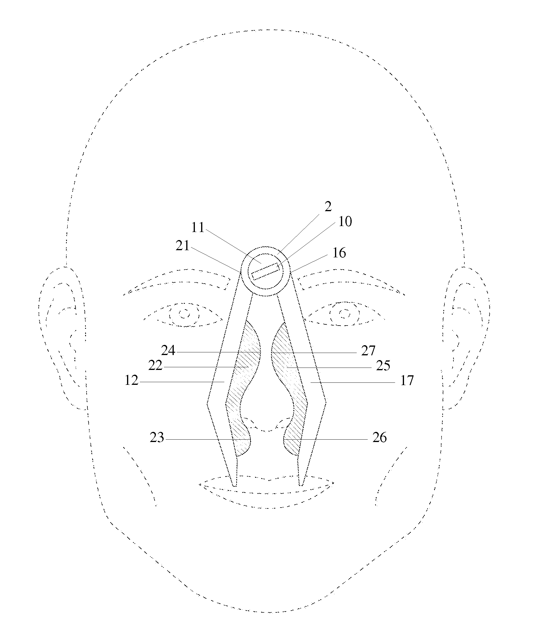 Adjustable locking forceps device for the treatment of anterior epistaxis and method of use