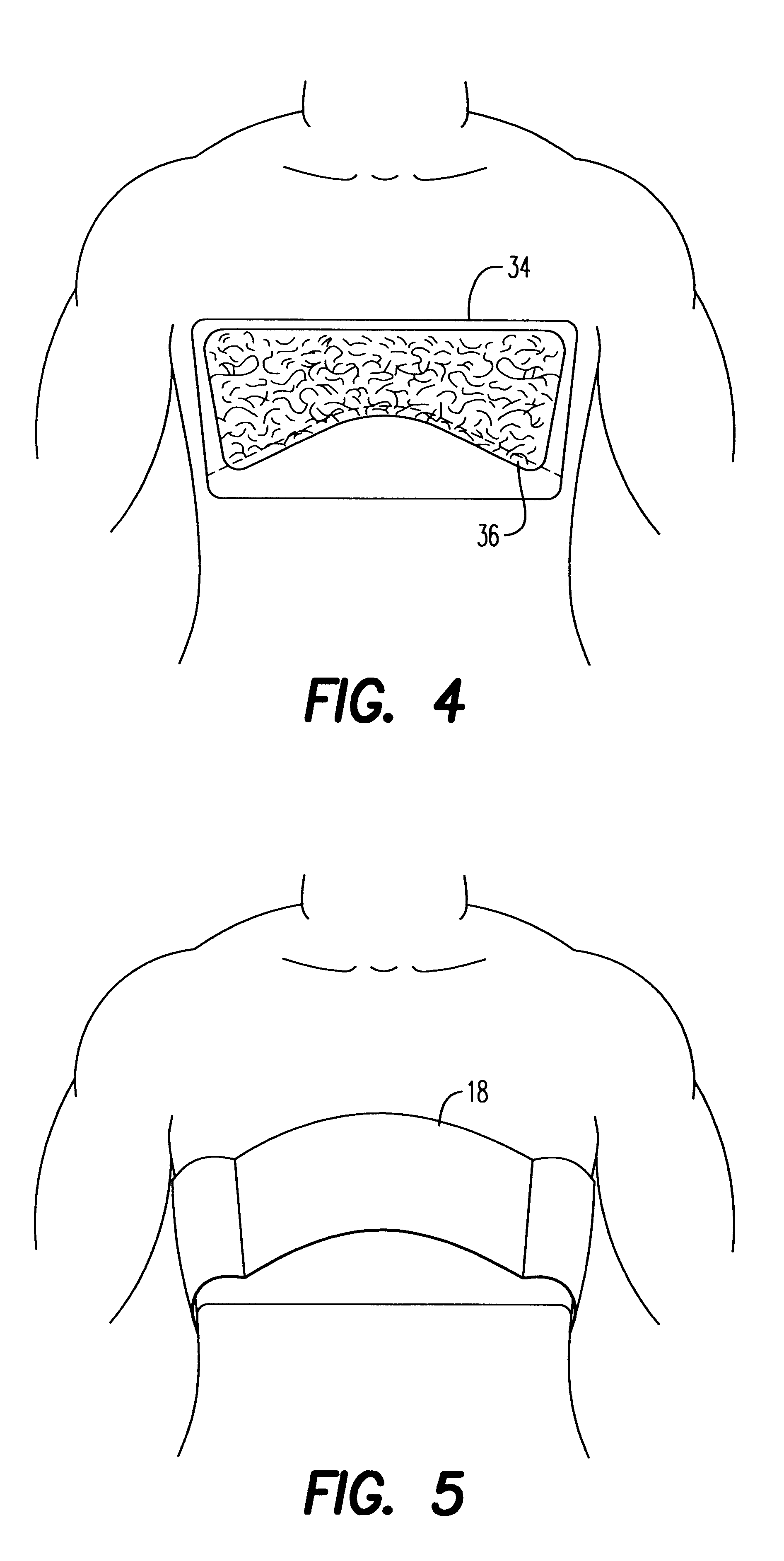 Chest brace and method of using same
