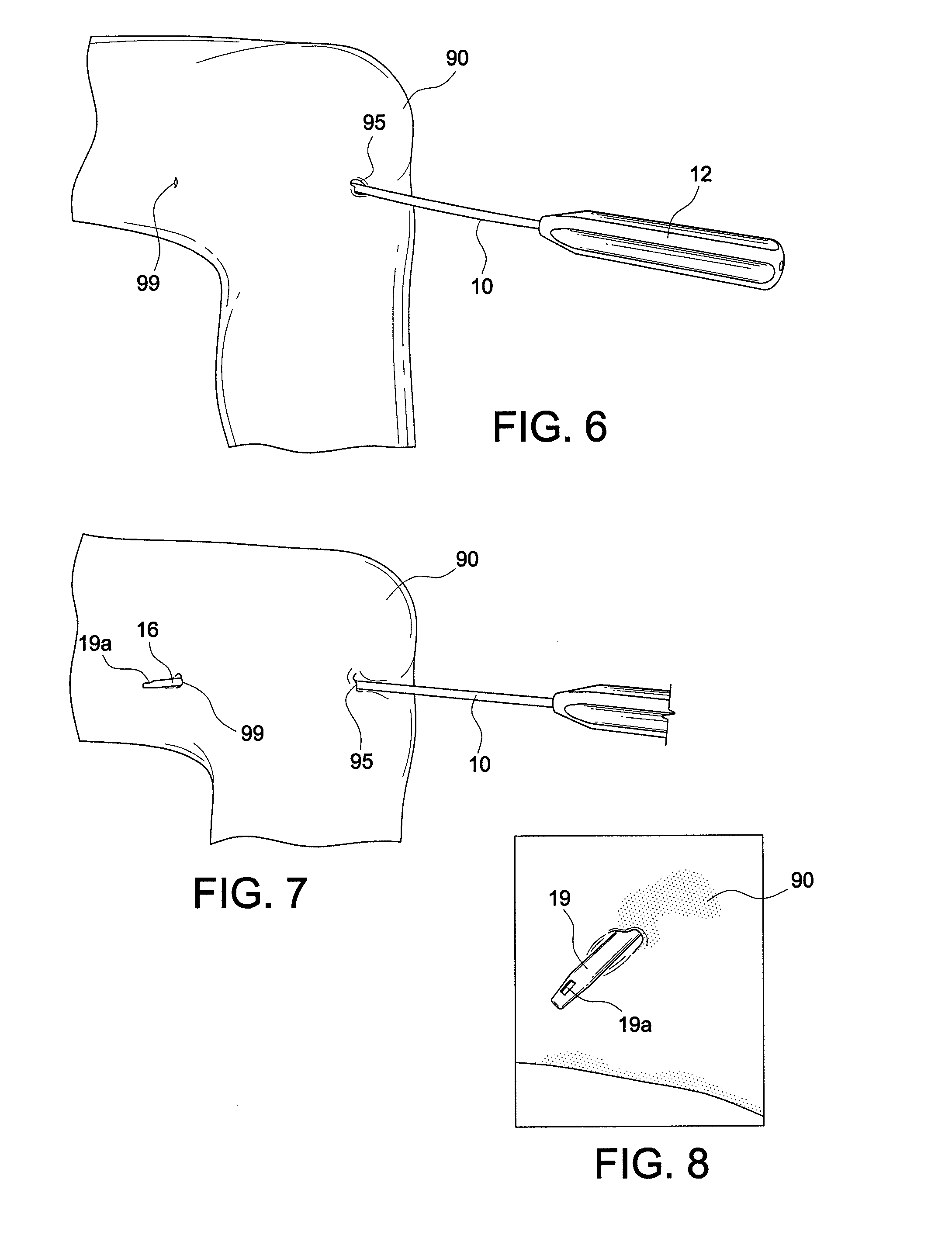 Methods and instrumentals for forming a posterior knee portal and for inserting a cannula