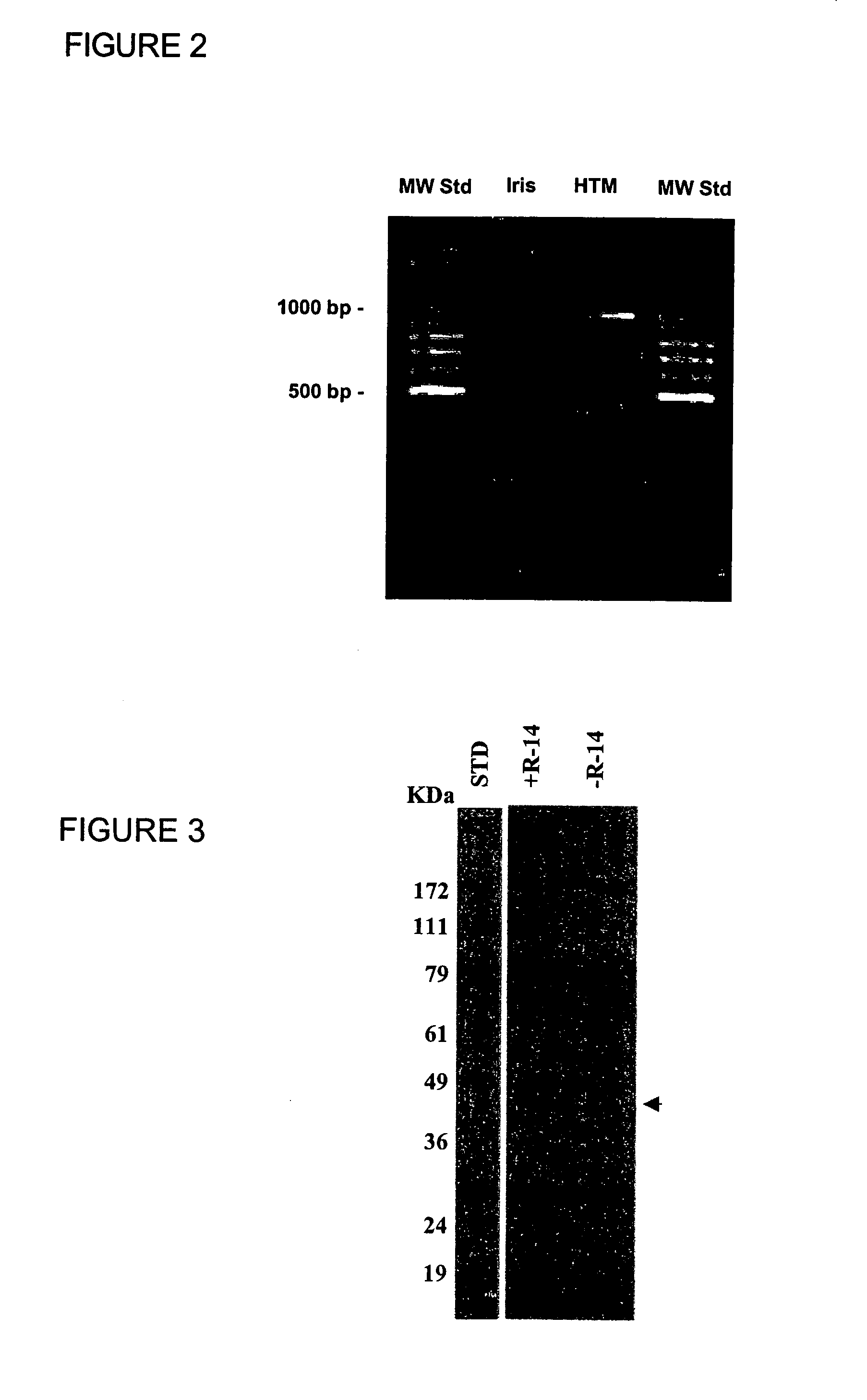 Methods and compounds for prevention and treatment of elevated intraocular pressure and related conditions