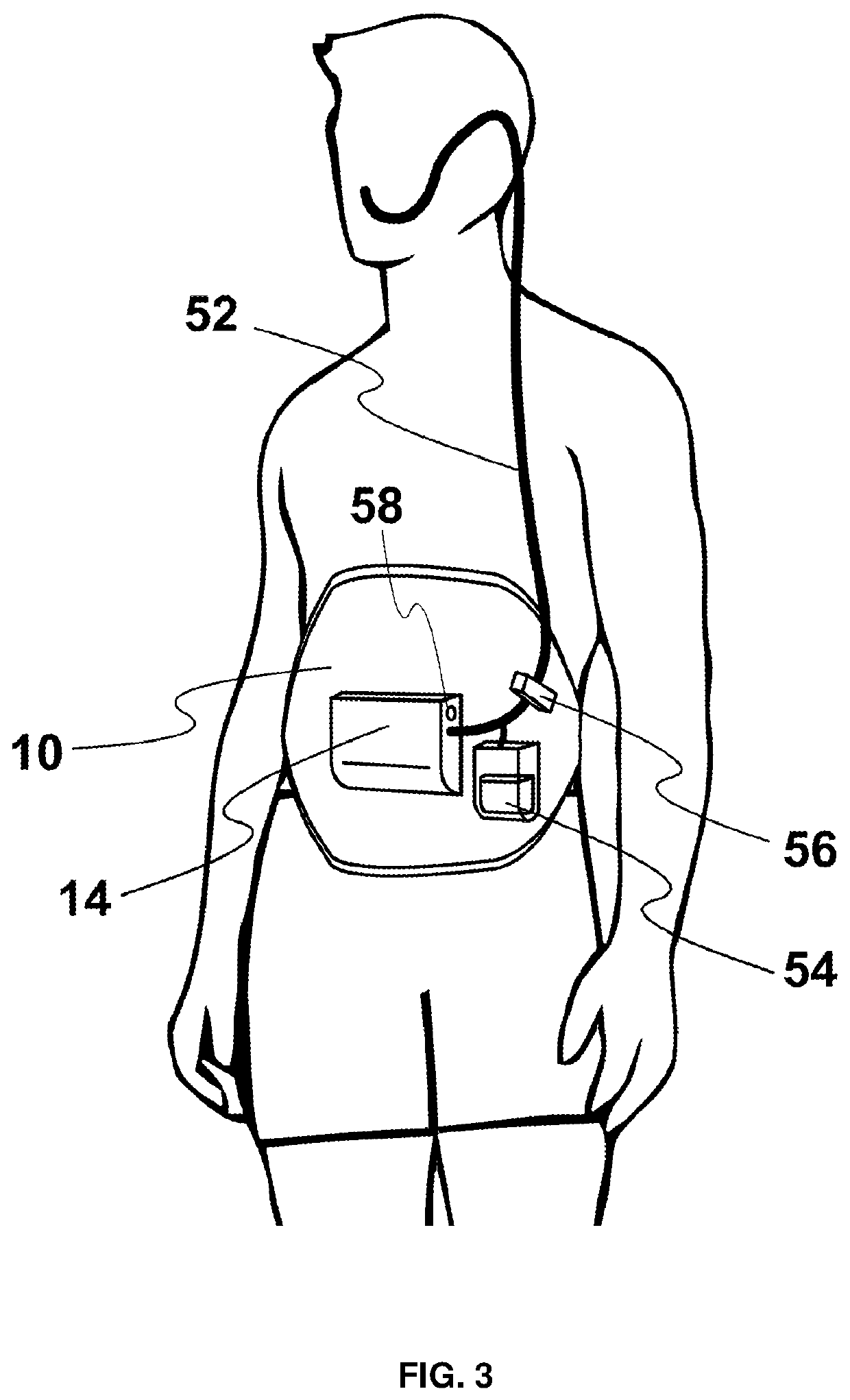 Innovations in mechanical ventilators