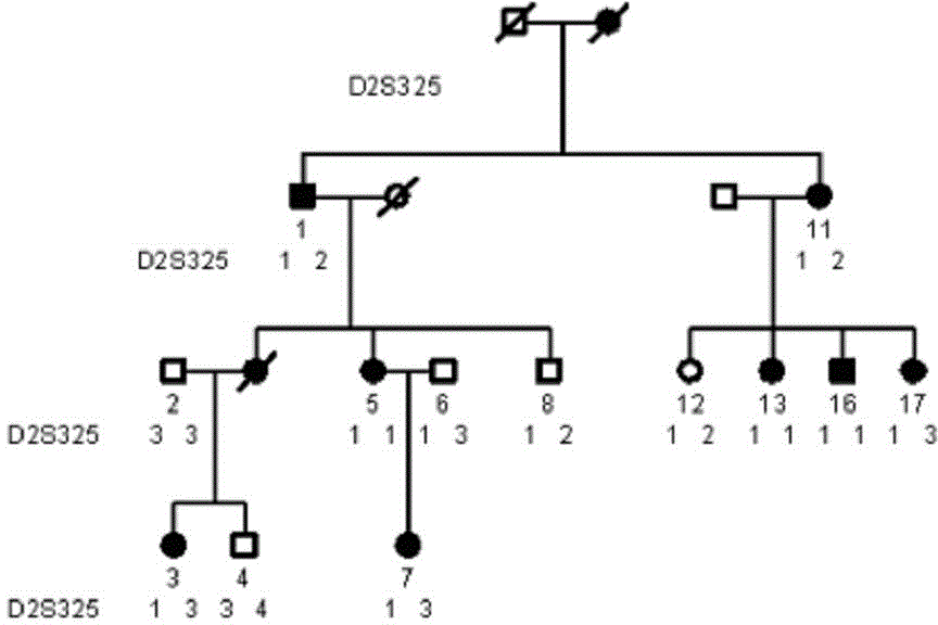 Detection kit of disease-causing gene CRYGD of crystalline congenital cataract