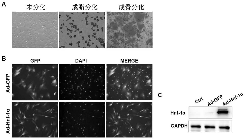 Application of Hnf-1alpha gene modified mesenchymal stem cells in prevention and treatment of liver cancer
