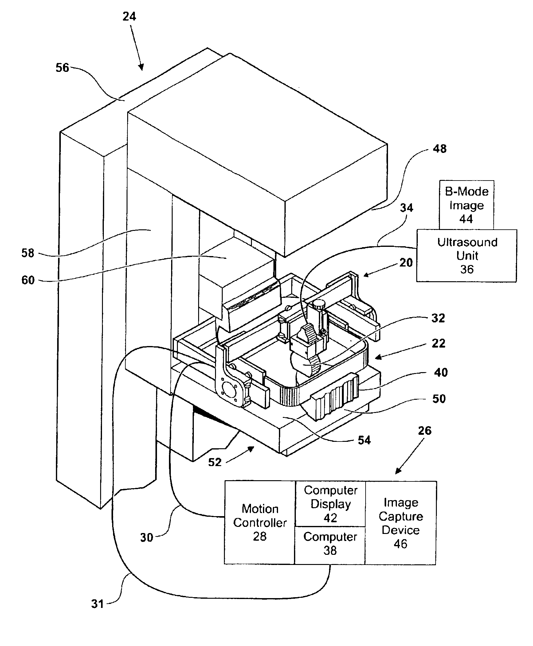 Mammography method and apparatus