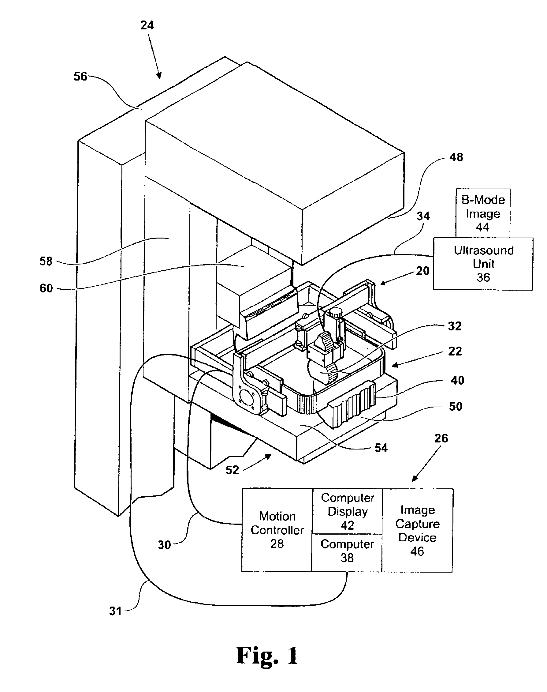 Mammography method and apparatus