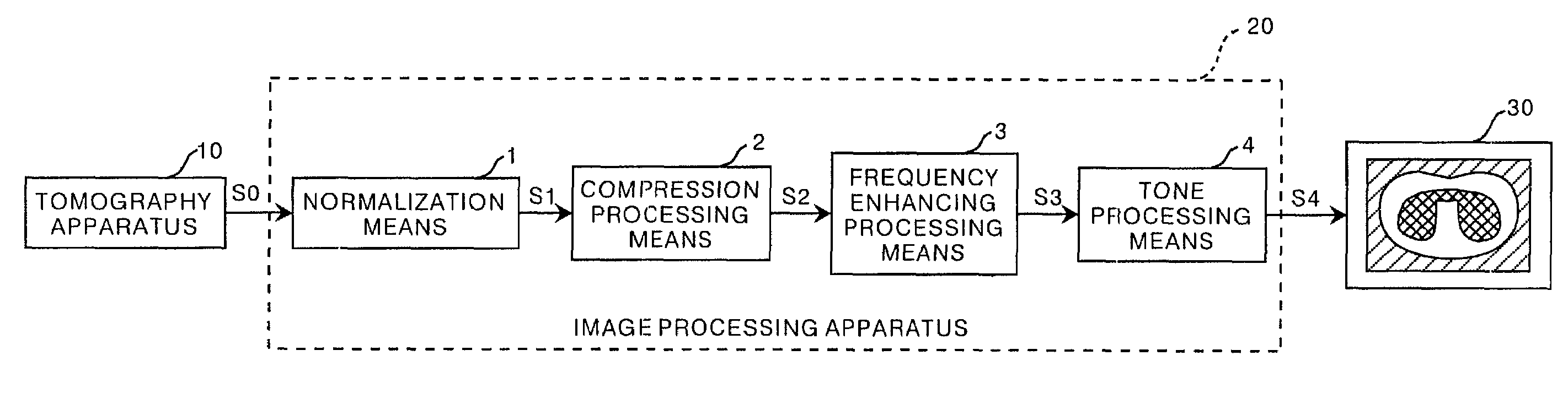 Method, apparatus, and recording medium for processing tomographic image