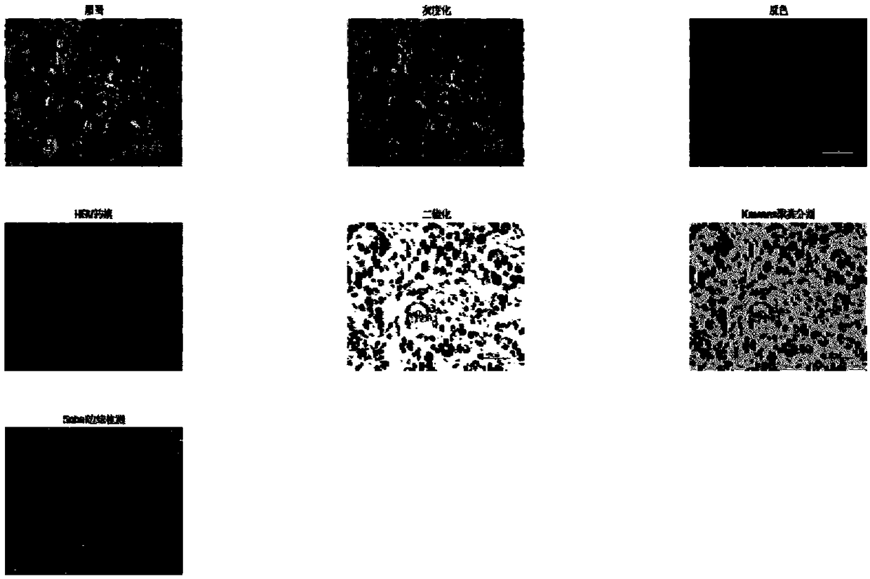 A membrane-based classification method for pathological microscopic images