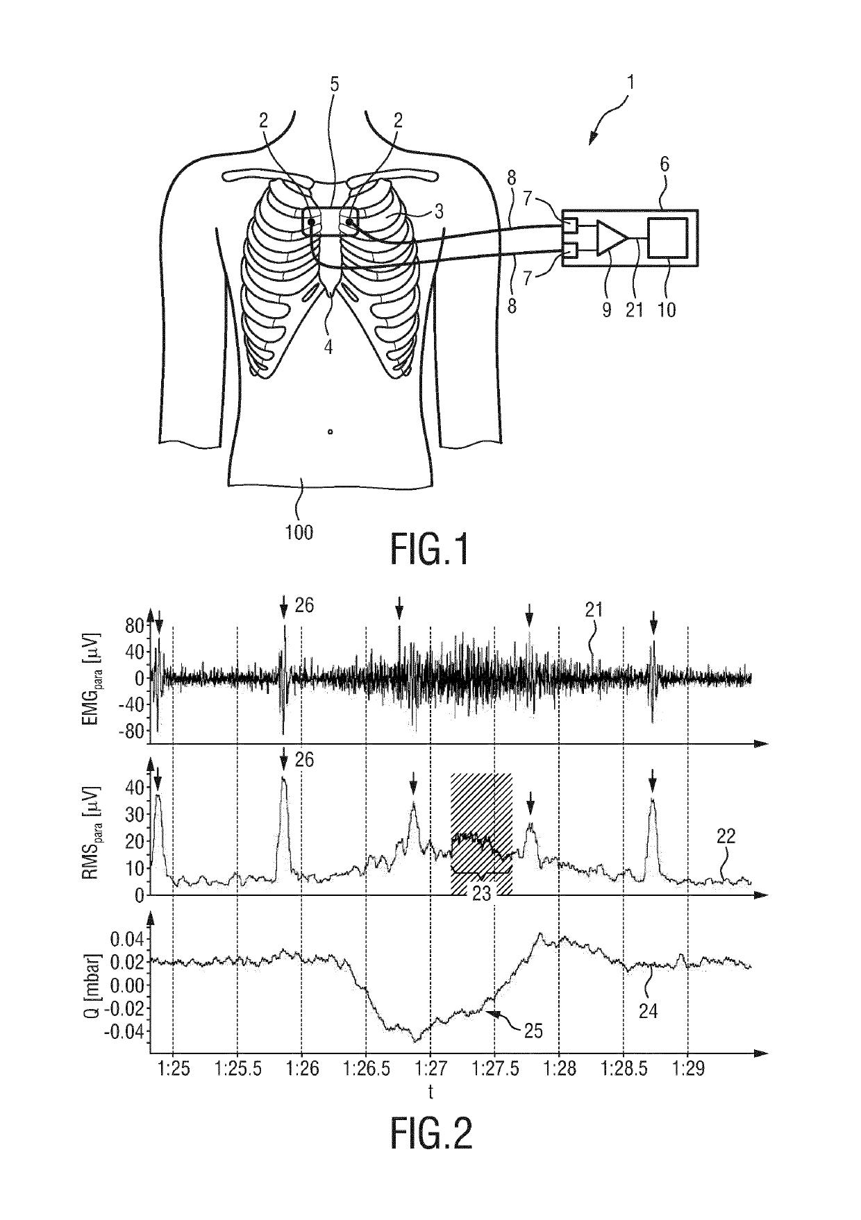 Processing apparatus for processing a physiological signal