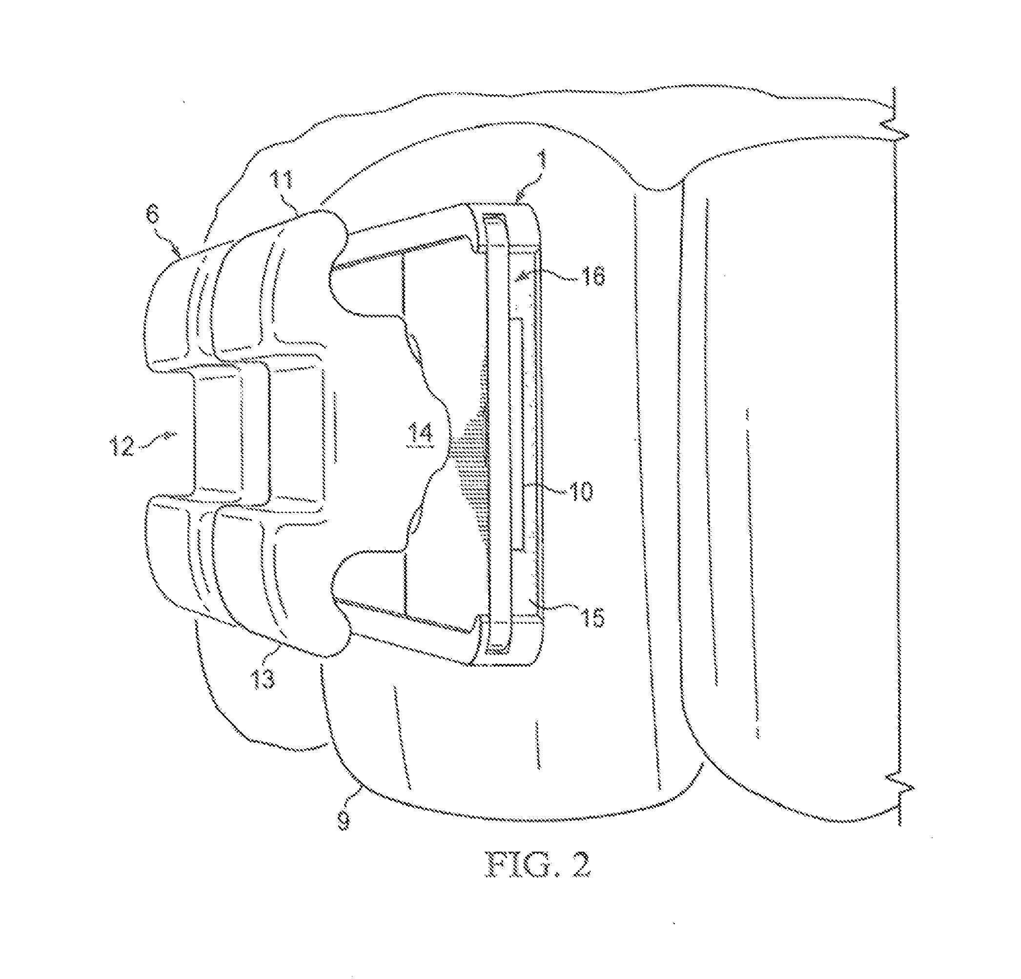 Dynamic Bracket System