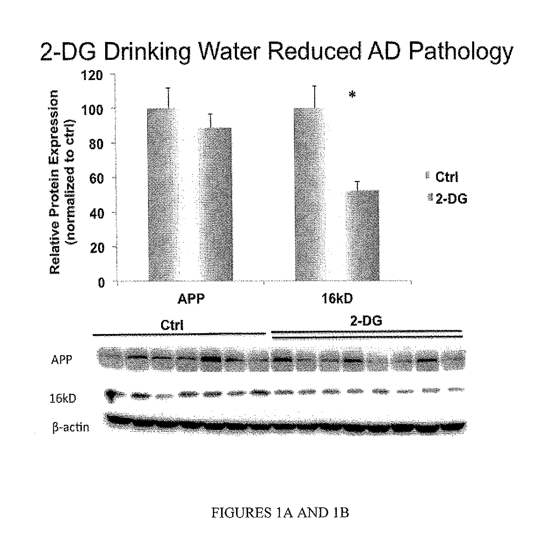 2-deoxy-d-glucose formulations for prevention or treatment of neurodegenerative diseases