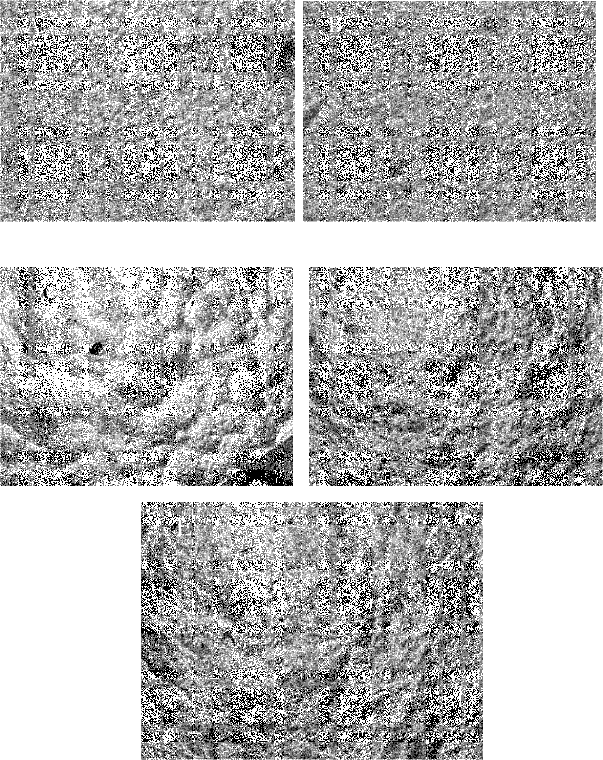 Chitosan/ Curdlan blended membrane material and preparation method thereof