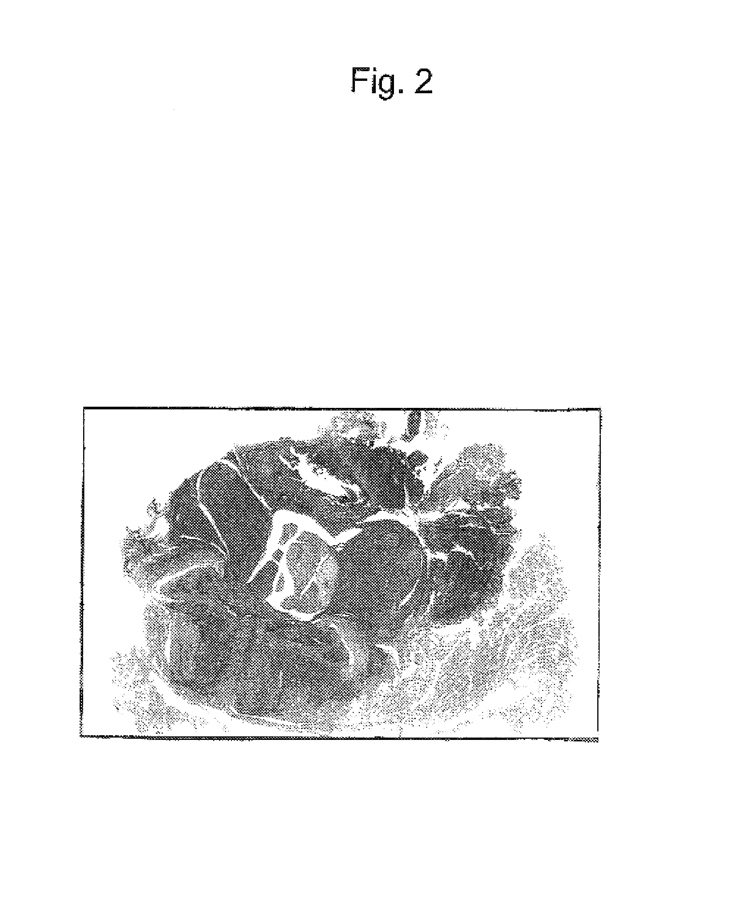 Animal model of human hematopoietic tumor