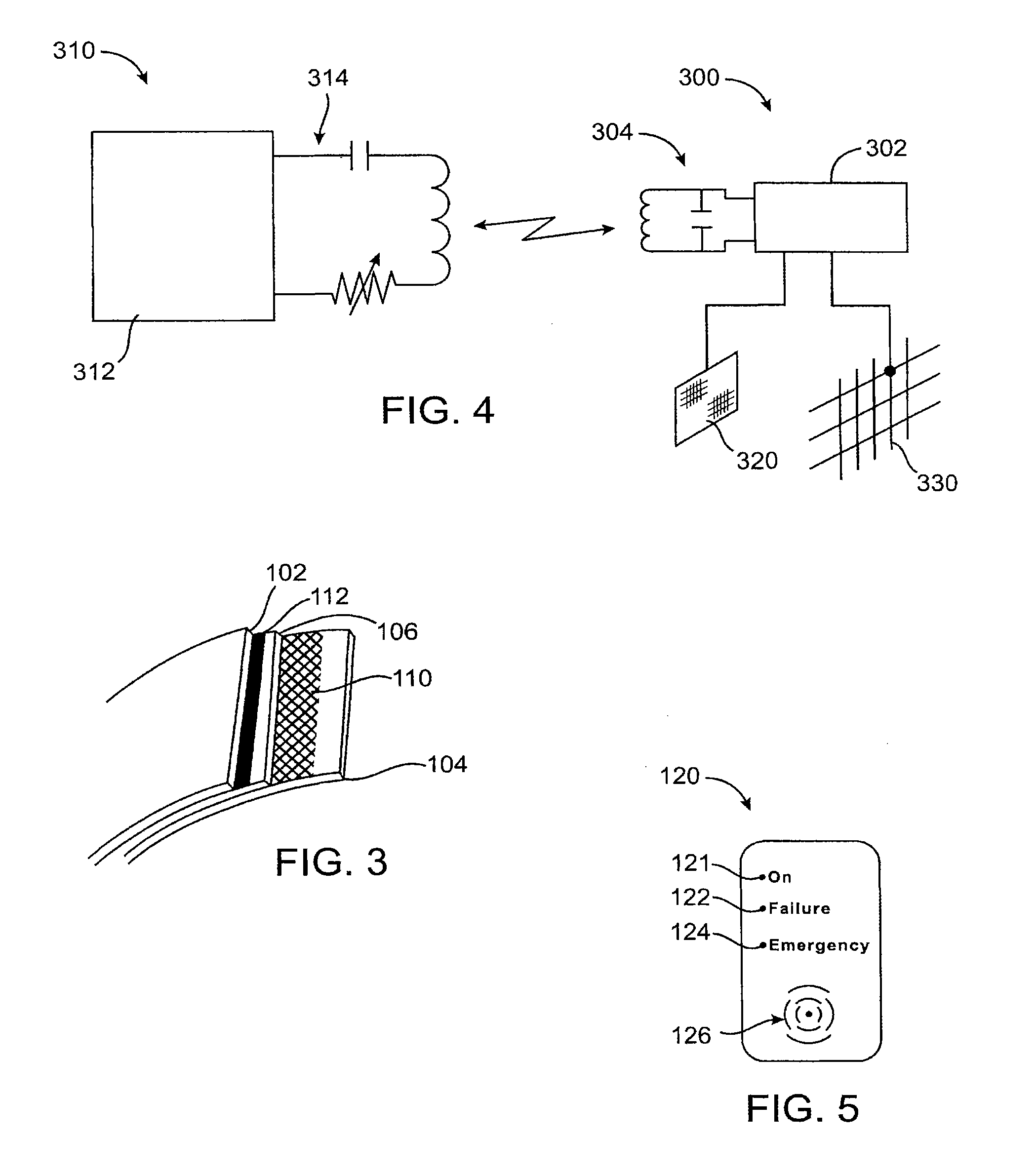 Methods, devices, and systems for obesity treatment