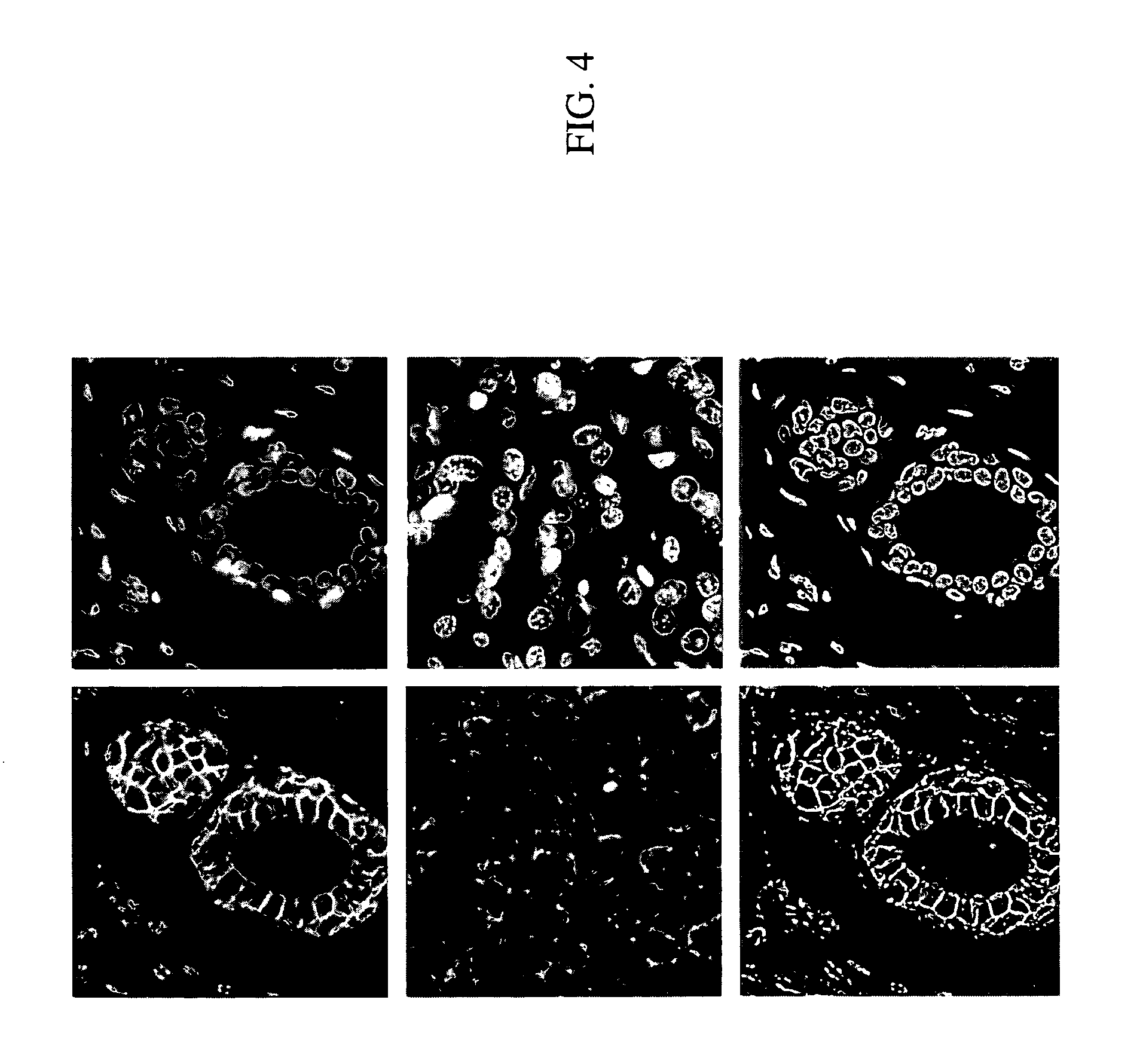 System and methods for scoring images of a tissue micro array