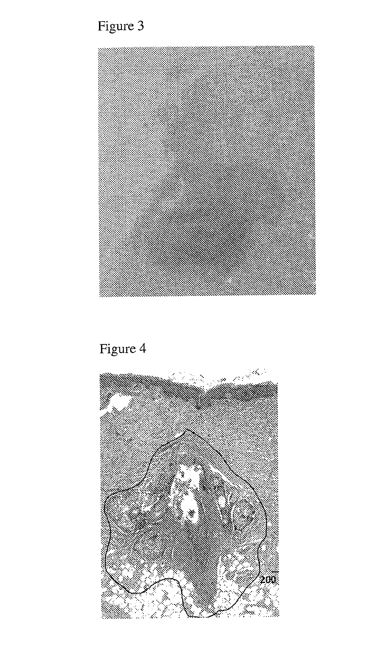 Treatment intervals for use of compositions comprising energy absorbing materials for dermatological applications