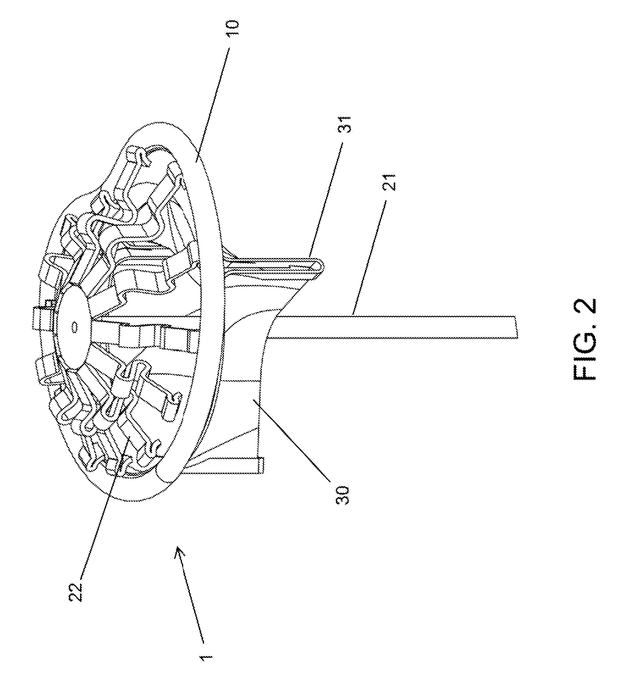 System and Method for Heart Valve Anchoring